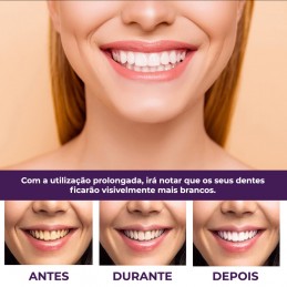 Un produit de soins dentaires haut de gamme qui vous aidera à obtenir le sourire plus blanc dont vous avez toujours rêvé.