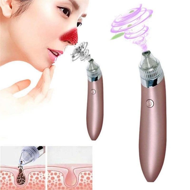 Acne and Blackheads Facial Cleansing Machine 4 in 1