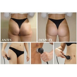Appareil de cavitation BioSonyc