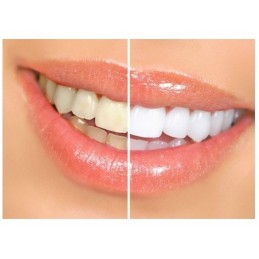 Questo sbiancante restituisce lucentezza e colore bianco ai tuoi denti, migliorando i risultati della spazzolatura regolare.